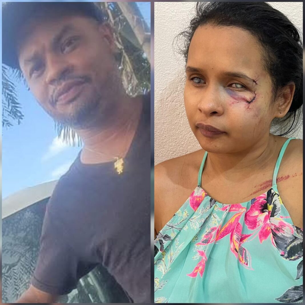 Mujer denuncia agresión por parte de su expareja en Monseñor Nouel