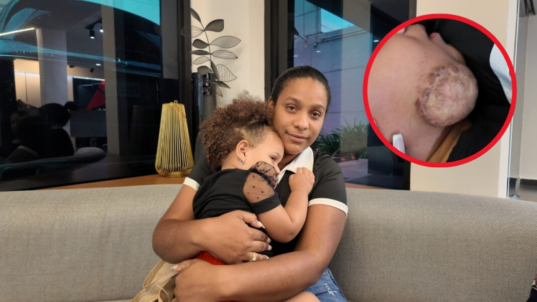Madre pide ayuda para su hija con hemangioma; necesita más de un millón para tratamiento