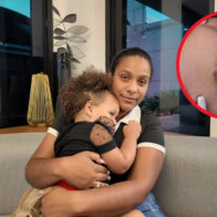 Madre pide ayuda para su hija con hemangioma; necesita más de un millón para tratamiento