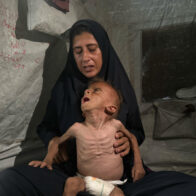 Enfermos y desnutridos, los niños de Gaza que Israel llama 'fake news' también pasan hambre