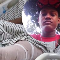 Solicitan ayuda económica para operación de joven accidentado en Santo Domingo - Noticias de hoy en República Dominicana | De Último Minuto