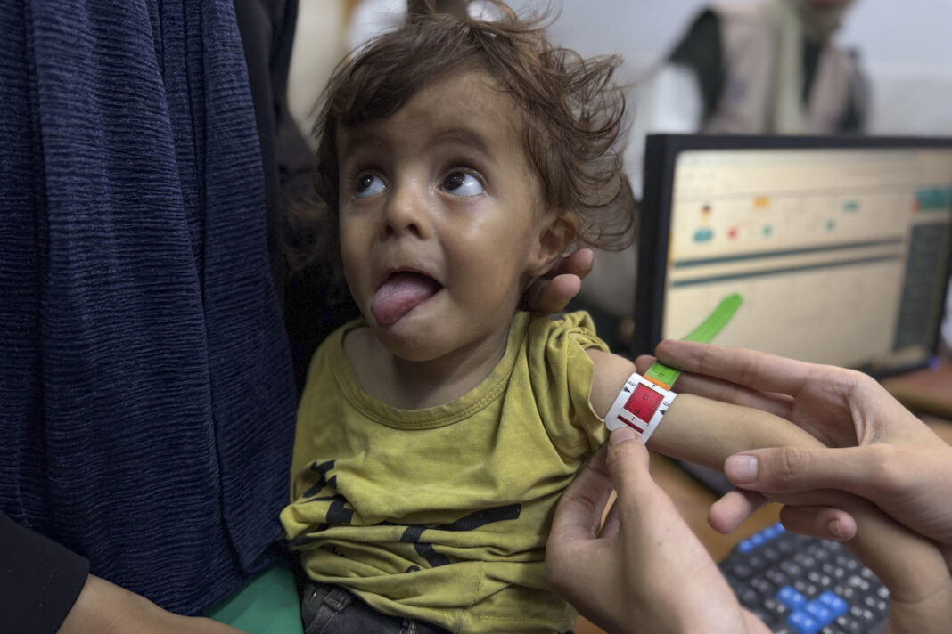 Dos personas murieron ayer por el hambre en Gaza, elevando el total a 271, según Sanidad