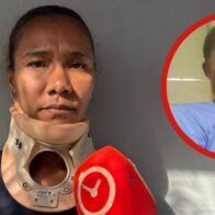 Orden de arresto sin ejecutar: mujer denuncia agresión en Villa Mella y advierte que teme por su vida