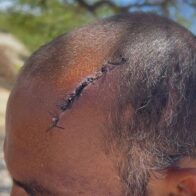 Hombre denuncia agresión a machetazos por parte de familiar de su ex pareja en Los Negros, Azua
