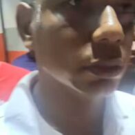 Joven resulta herido en intento de atraco en Los Jovillos, Azua