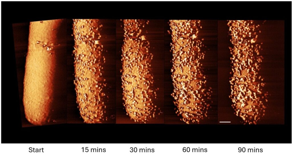 Captan las primeras imágenes de un antibiótico aniquilando bacterias en tiempo real - Noticias de hoy en República Dominicana | De Último Minuto