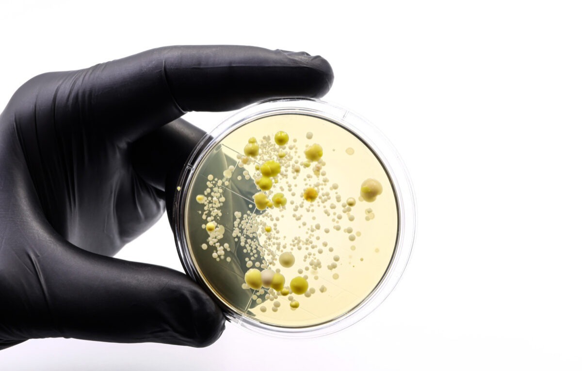 Descubren que un fármaco contra el cáncer es eficaz contra una bacteria multirresistente