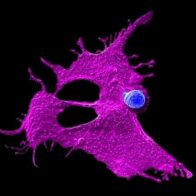 Nueva inmunoterapia contra el cáncer de páncreas - Noticias de hoy en República Dominicana | De Último Minuto