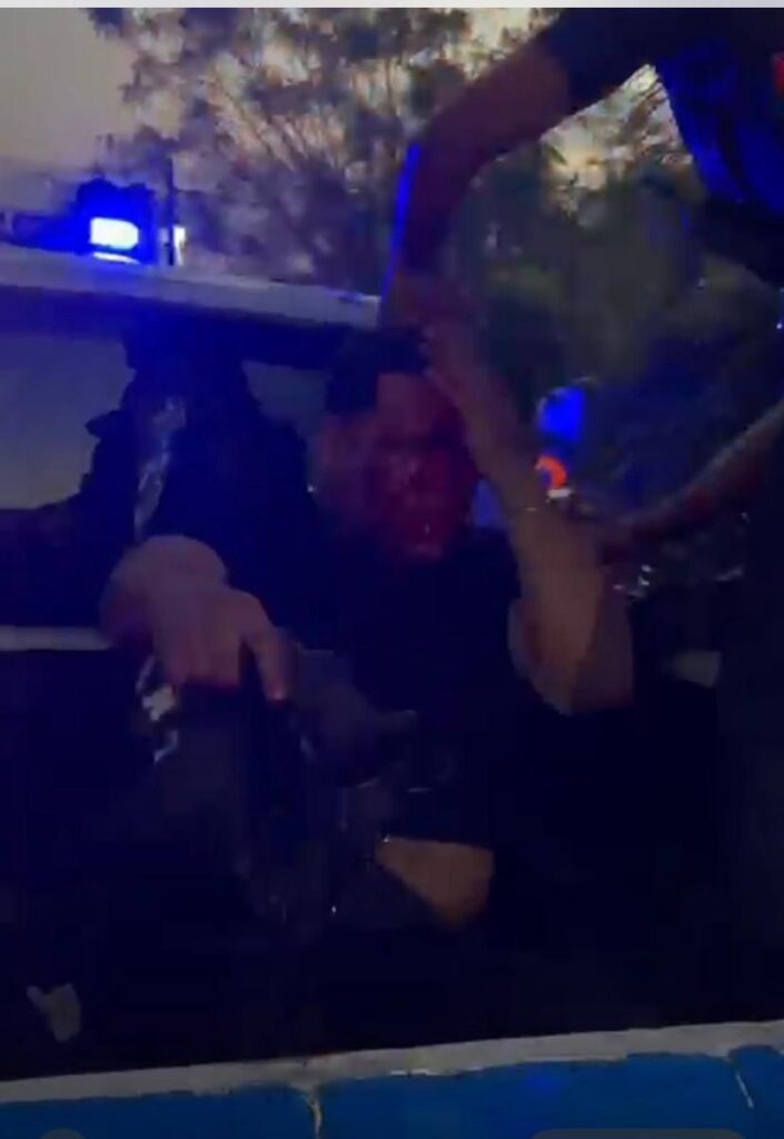 Golpean a “Mantequilla” tras presunta persecución en Monte Plata - Noticias de hoy en República Dominicana | De Último Minuto