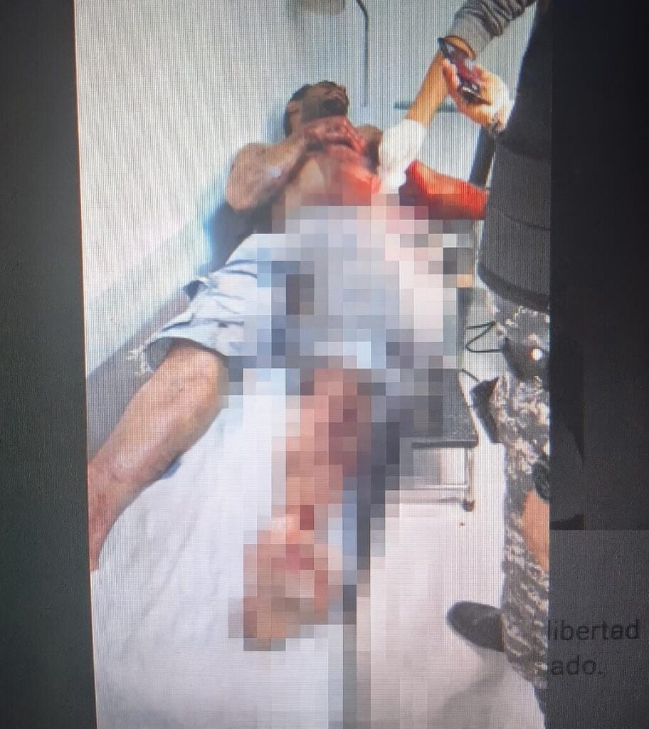 Preso apuñala a otro en cárcel preventiva de la policía en La Vega | 2 | Preso apuñala a otro en cárcel preventiva de la policía en La Vega - Noticias de hoy en República Dominicana | De Último Minuto