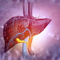 Análisis de sangre revela enfermedad hepática relacionada con el alcohol