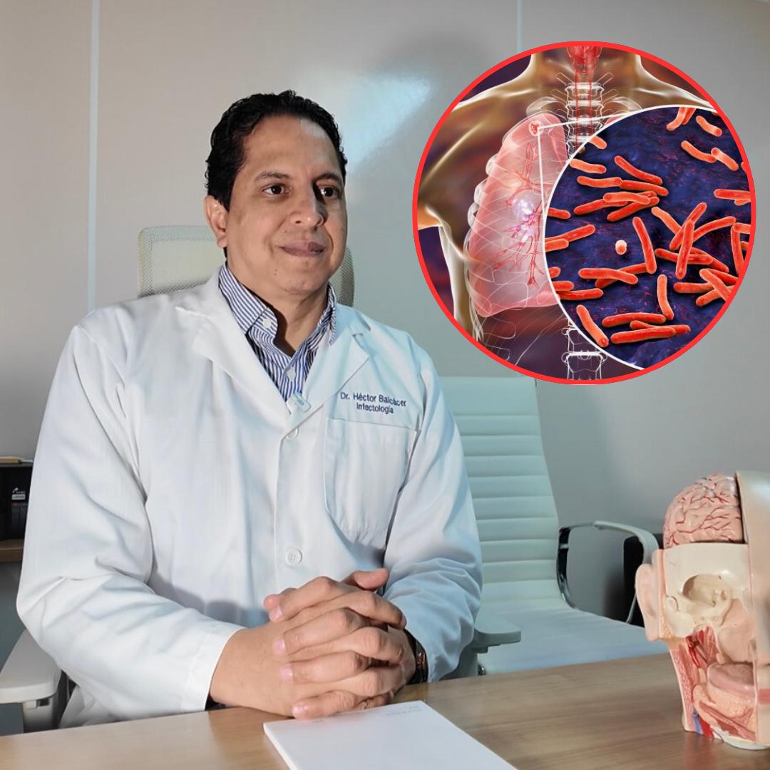 Entre 3,000 y 4,000 casos de tuberculosis se detectan cada año en el país - Noticias de hoy en República Dominicana | De Último Minuto