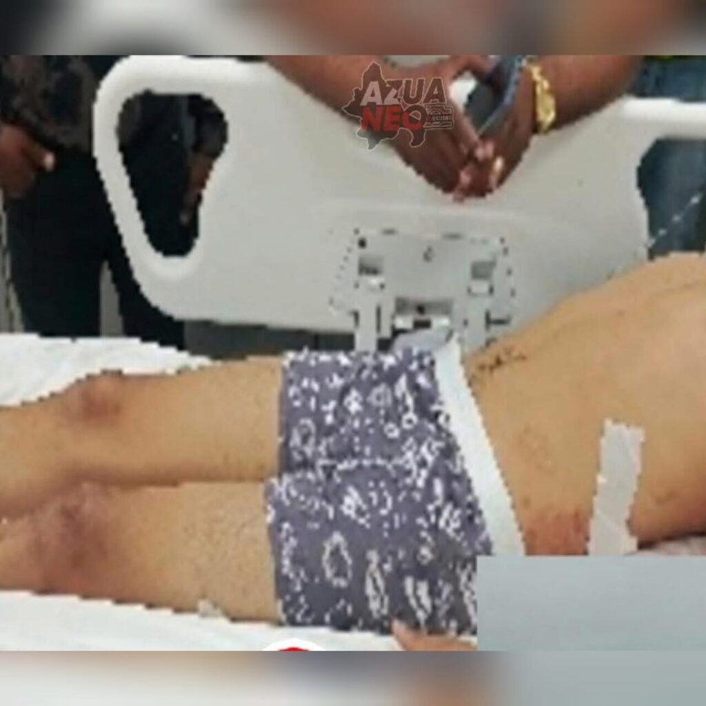 Hieren de bala a joven en tiroteo en Azua; autoridades profundizan investigación | 2 | Hieren de bala a joven en tiroteo en Azua; autoridades profundizan investigación - Noticias de hoy en República Dominicana | De Último Minuto