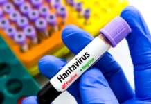 Confirman muerte por hantavirus en Colorado; autoridades investigan el caso