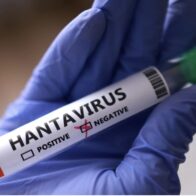 OMS: hantavirus sólo se transmite por contacto estrecho, con posible exposición a saliva - Noticias de hoy en República Dominicana | De Último Minuto