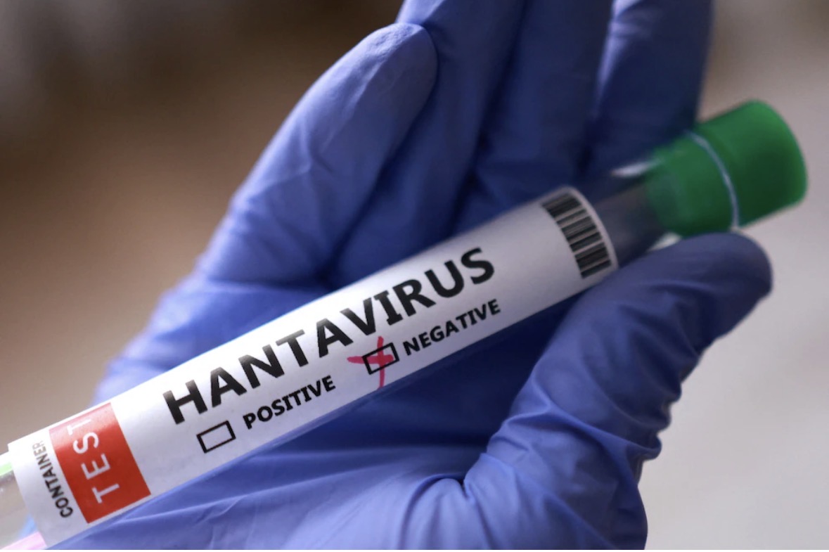 OMS: hantavirus sólo se transmite por contacto estrecho, con posible exposición a saliva - Noticias de hoy en República Dominicana | De Último Minuto