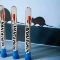 La OMS mantiene en once los casos de hantavirus y un riesgo bajo para la población
