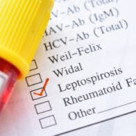Salud Pública reporta aumento de leptospirosis en el país; casos ascienden a 74