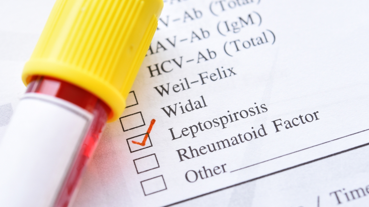 Salud Pública reporta aumento de leptospirosis en el país; casos ascienden a 74
