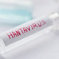 OMS eleva a 11 los casos de hantavirus vinculados a crucero MV Hondius