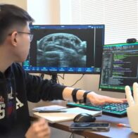 Pulsera del MIT permite a robots aprender habilidades humanas - Noticias de hoy en República Dominicana | De Último Minuto