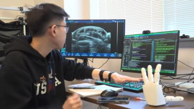 Pulsera del MIT permite a robots aprender habilidades humanas - Noticias de hoy en República Dominicana | De Último Minuto