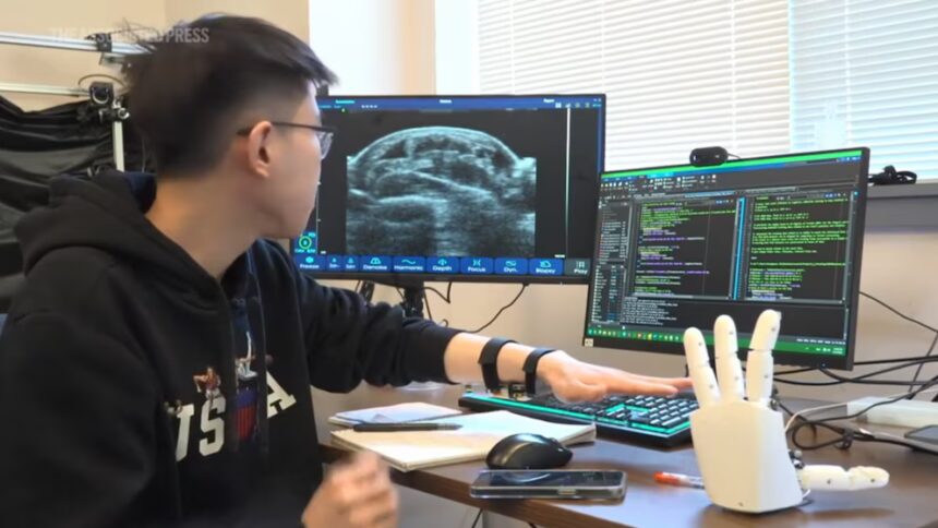 Pulsera del MIT permite a robots aprender habilidades humanas - Noticias de hoy en República Dominicana | De Último Minuto