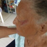 Adulta mayor de 84 años denuncia agresión por parte de hijo de crianza