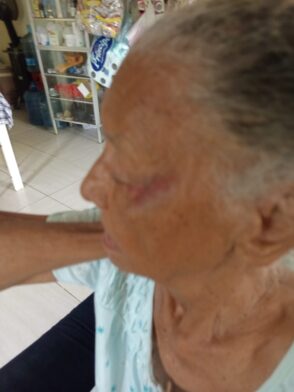 Adulta mayor de 84 años denuncia agresión por parte de hijo de crianza