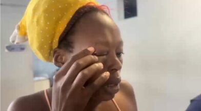 Hombre agrede a su expareja haitiana y le provoca lesiones en el rostro en San Francisco de Macorís