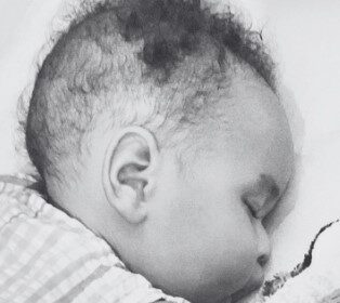 Muere bebé con atrofia muscular espinal que esperaba acceso a medicamento