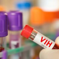República Dominicana registra epidemia de VIH, según la OPS