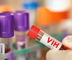 República Dominicana registra epidemia de VIH, según la OPS