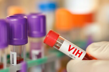 República Dominicana registra epidemia de VIH, según la OPS