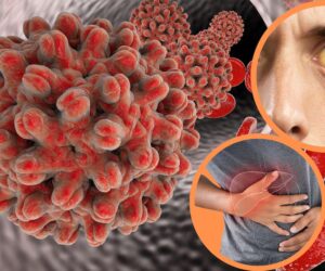 Costa Rica confirma 14 casos de hepatitis A y contaminación en sistema de agua